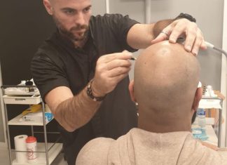 טיפול בנשירת שיער לגברים