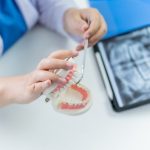 הכל על טיפולי שיניים ואסתטיקה פנים